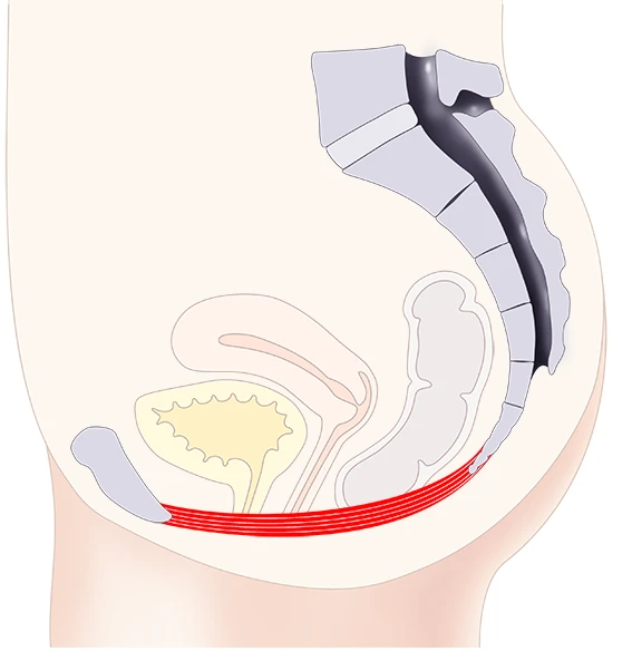 Anatomische Darstellung: Gestärkter Beckenboden nach EMSELLA®-Behandlung stützt die Organe